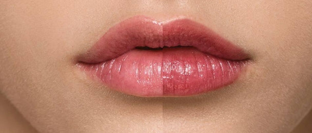 Supreme Lip Treatment – Himbeere-  MM004